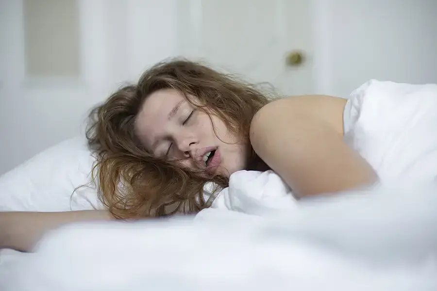 Woman sleeping peacefully on white bedding, demonstrating restful sleep benefits for sleep apnea management.