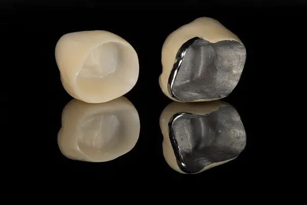 dental-crown