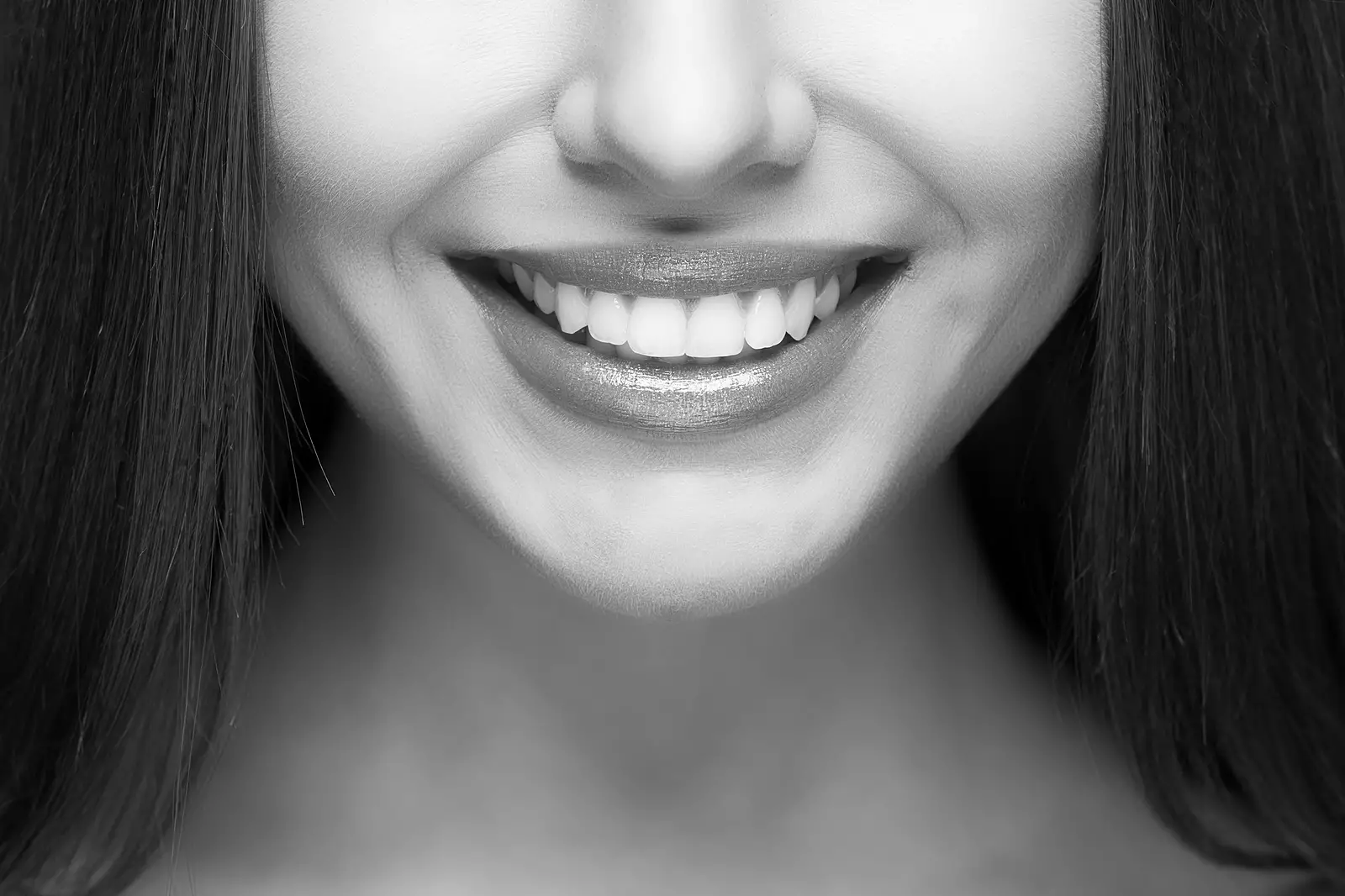 smile Makeover Lake-ridge