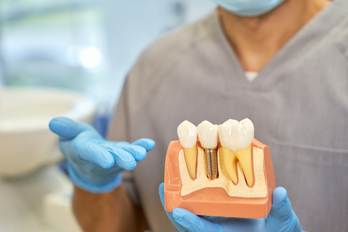 dental implants in Lake Ridge