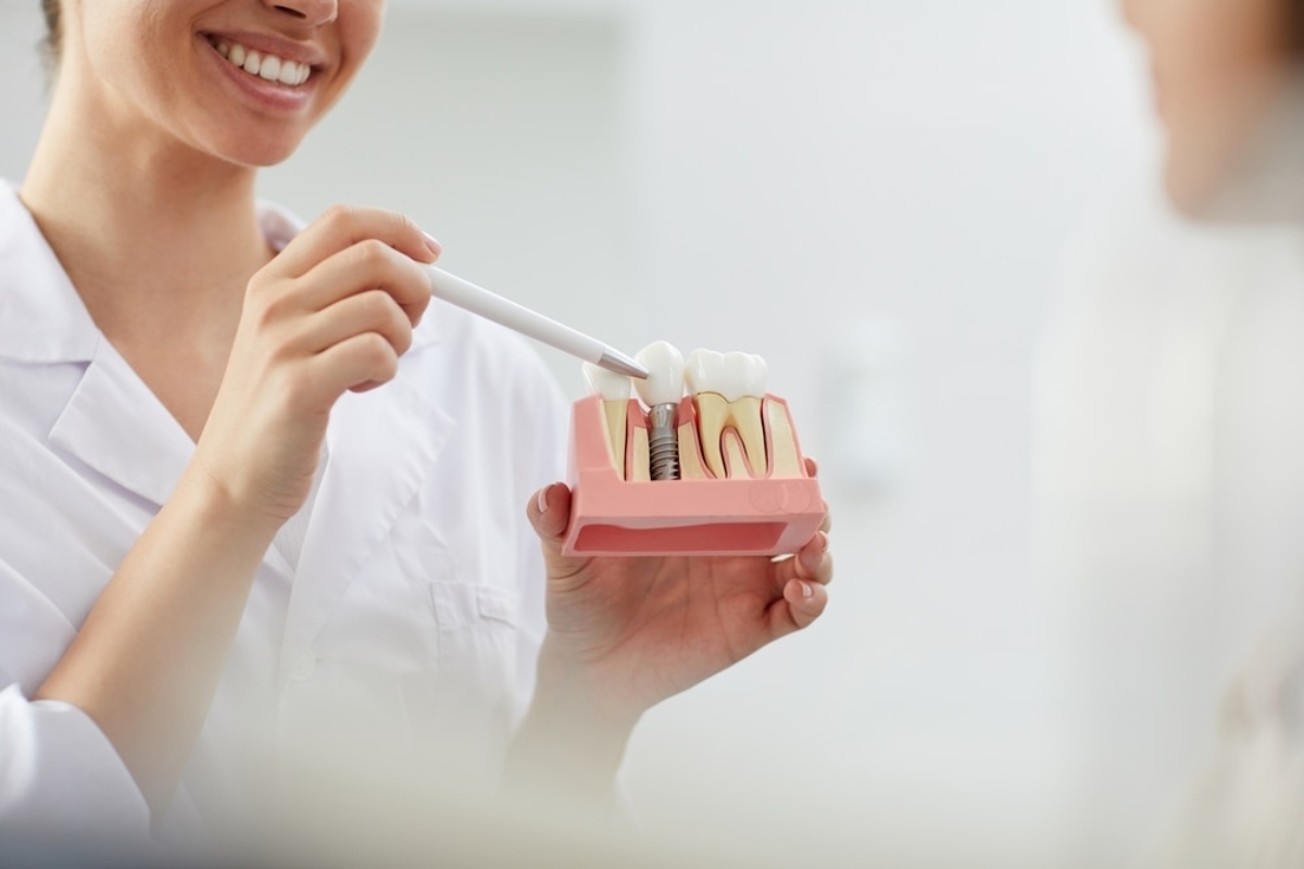 Dental professional demonstrating dental implant model showing tooth replacement structure to patient.