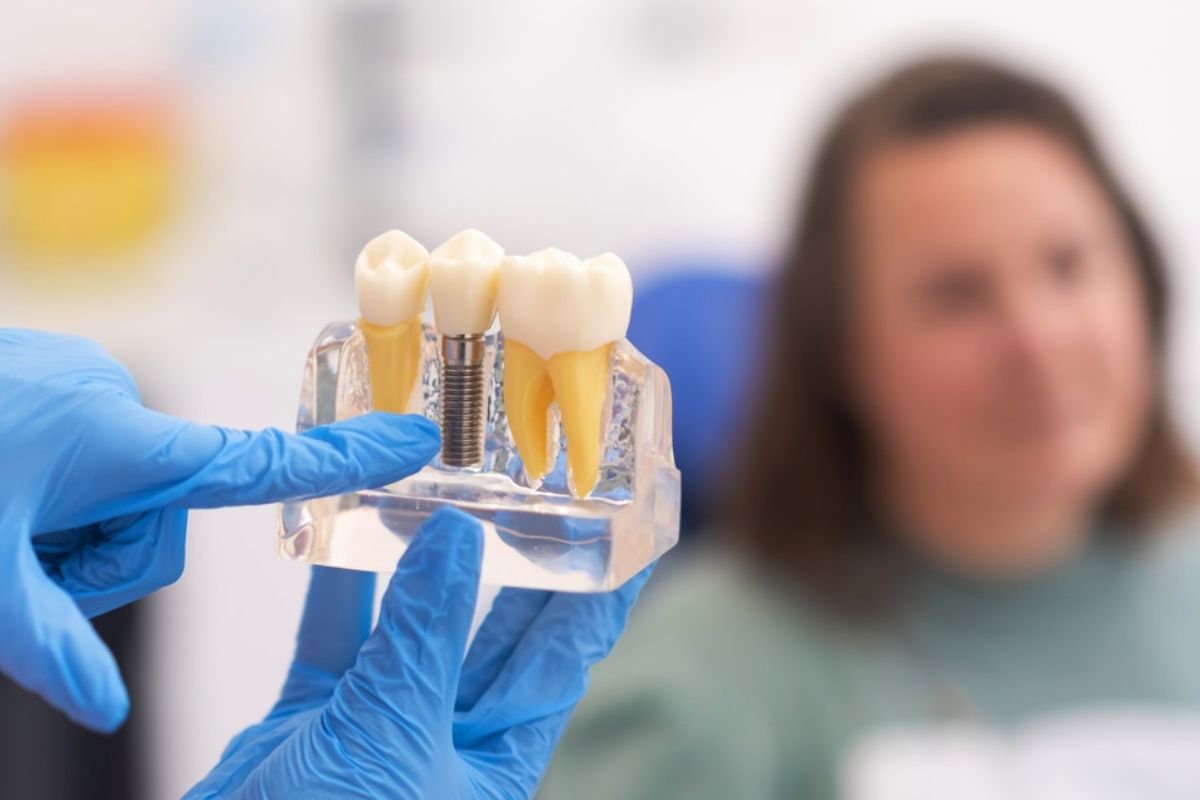 Care for Your Implants After Surgery