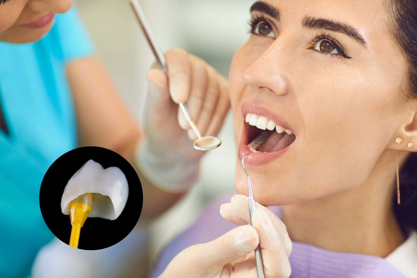 Same-Day Dental Crowns in Woodbridge