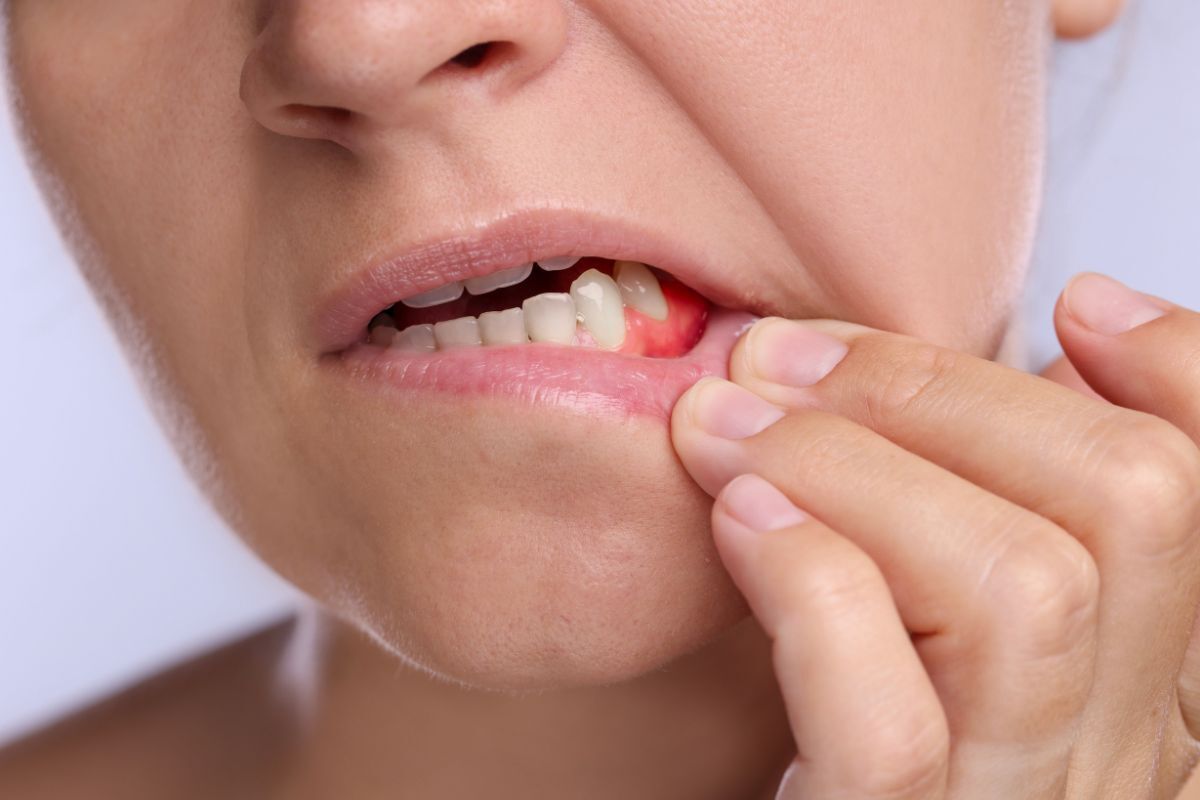 Child pointing to swollen gum with visible inflammation and tooth concern.