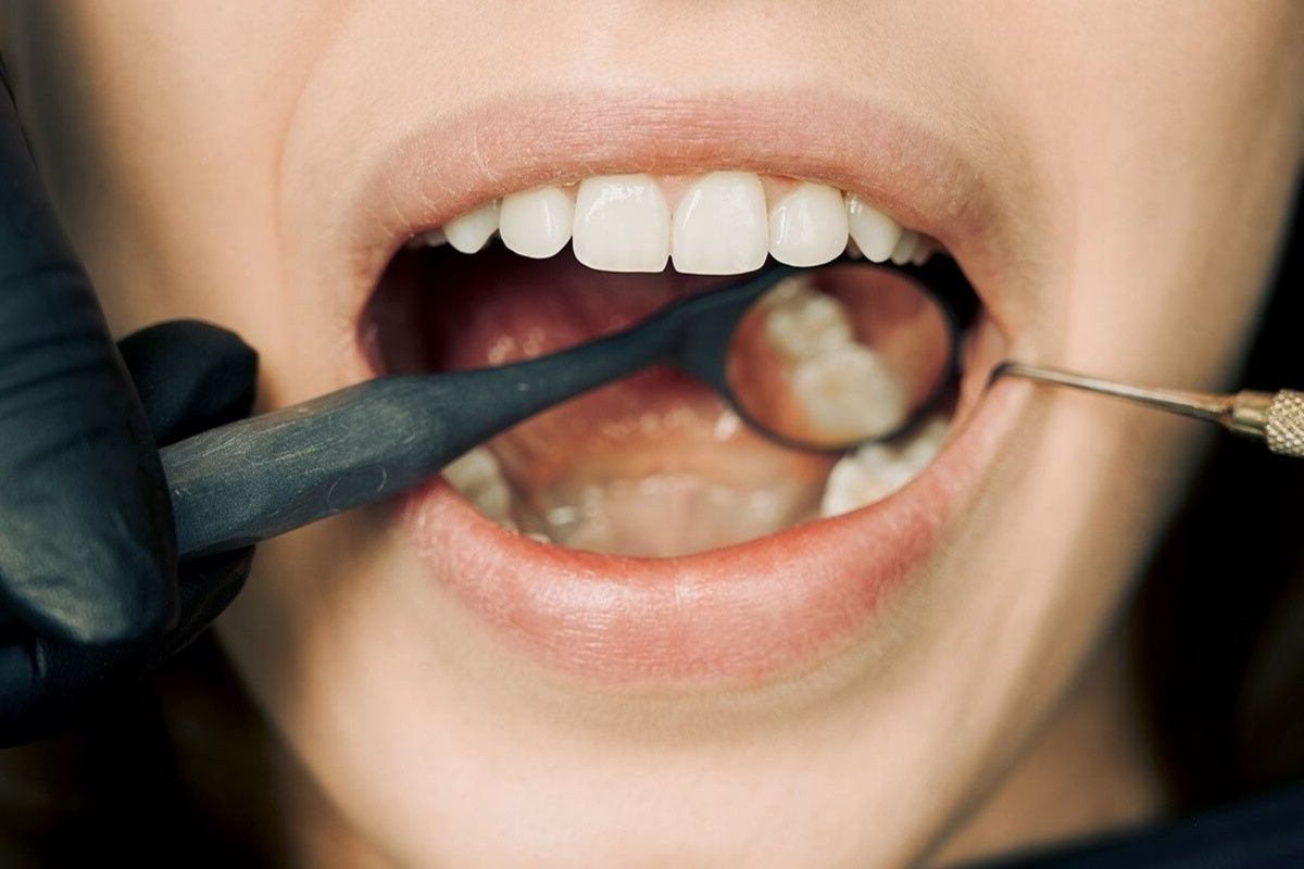 How Long Until A Tooth Infection Kills You