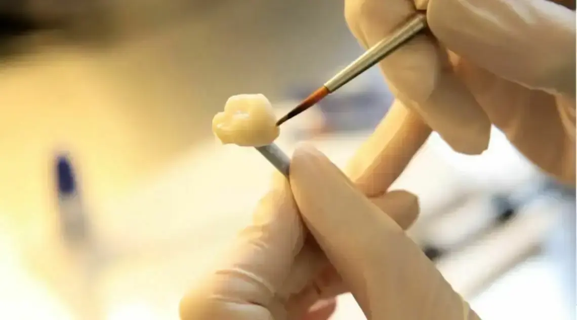 Dentist applying dental crown to patient tooth during same day crown procedure.