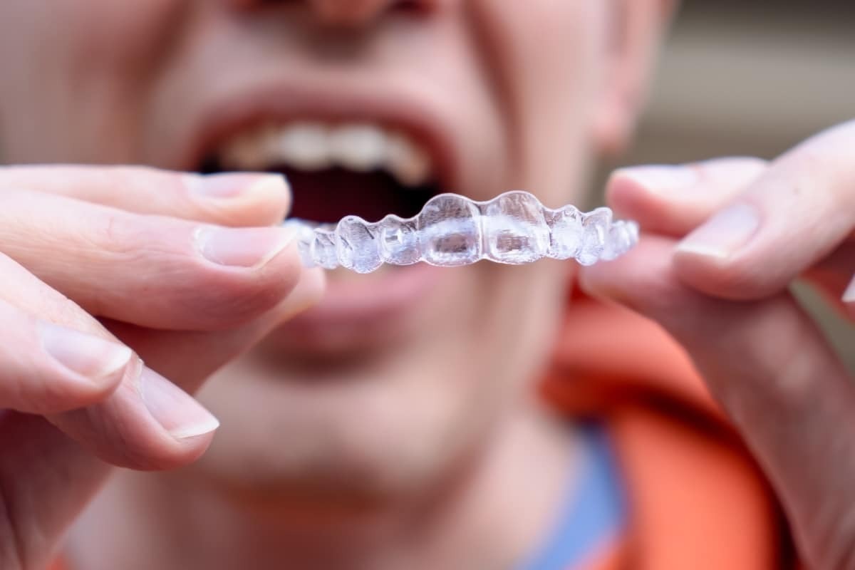 Close-up of clear Invisalign aligner held in hands showing tooth positioning details.