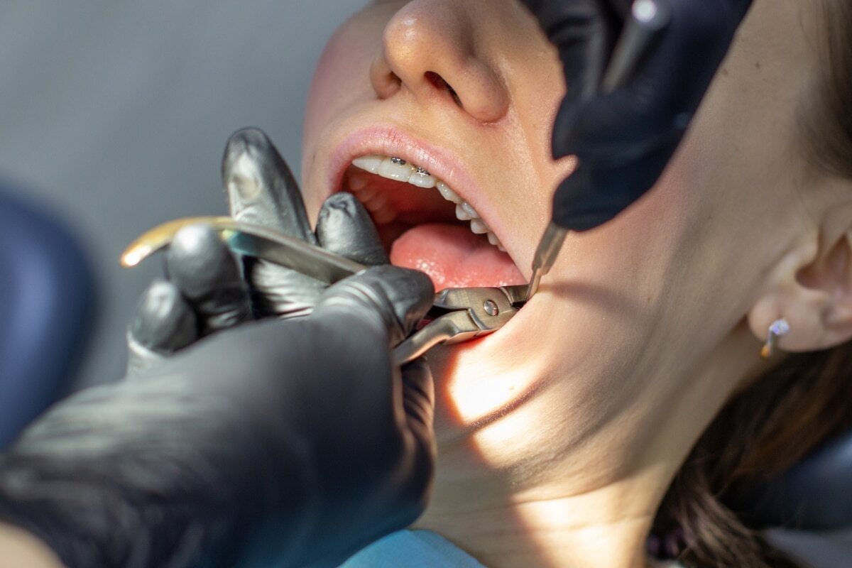 Dentist examining patient's teeth with dental mirror and light during oral examination.
