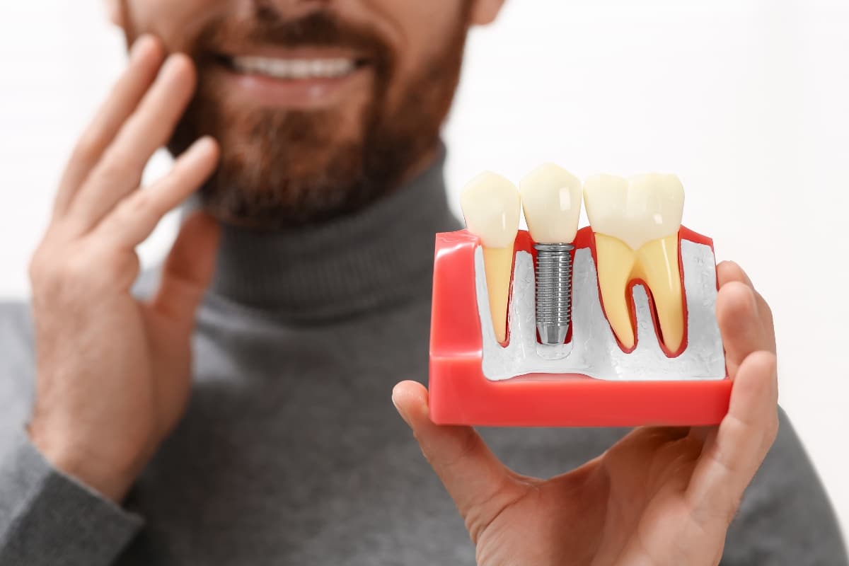 Dental Implants